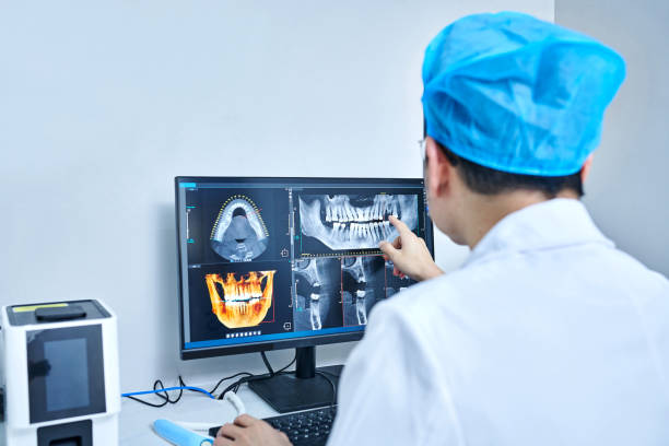 Best Emergency Treatment for Dental Infections or Abscesses in Sonoma State University, CA